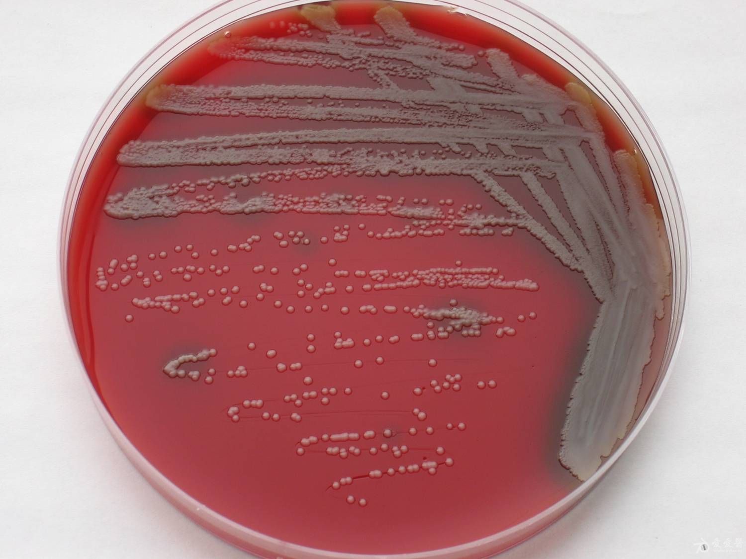  p>卡他莫拉菌(moraxella catarrhalis,简称mc) a target="_blank"