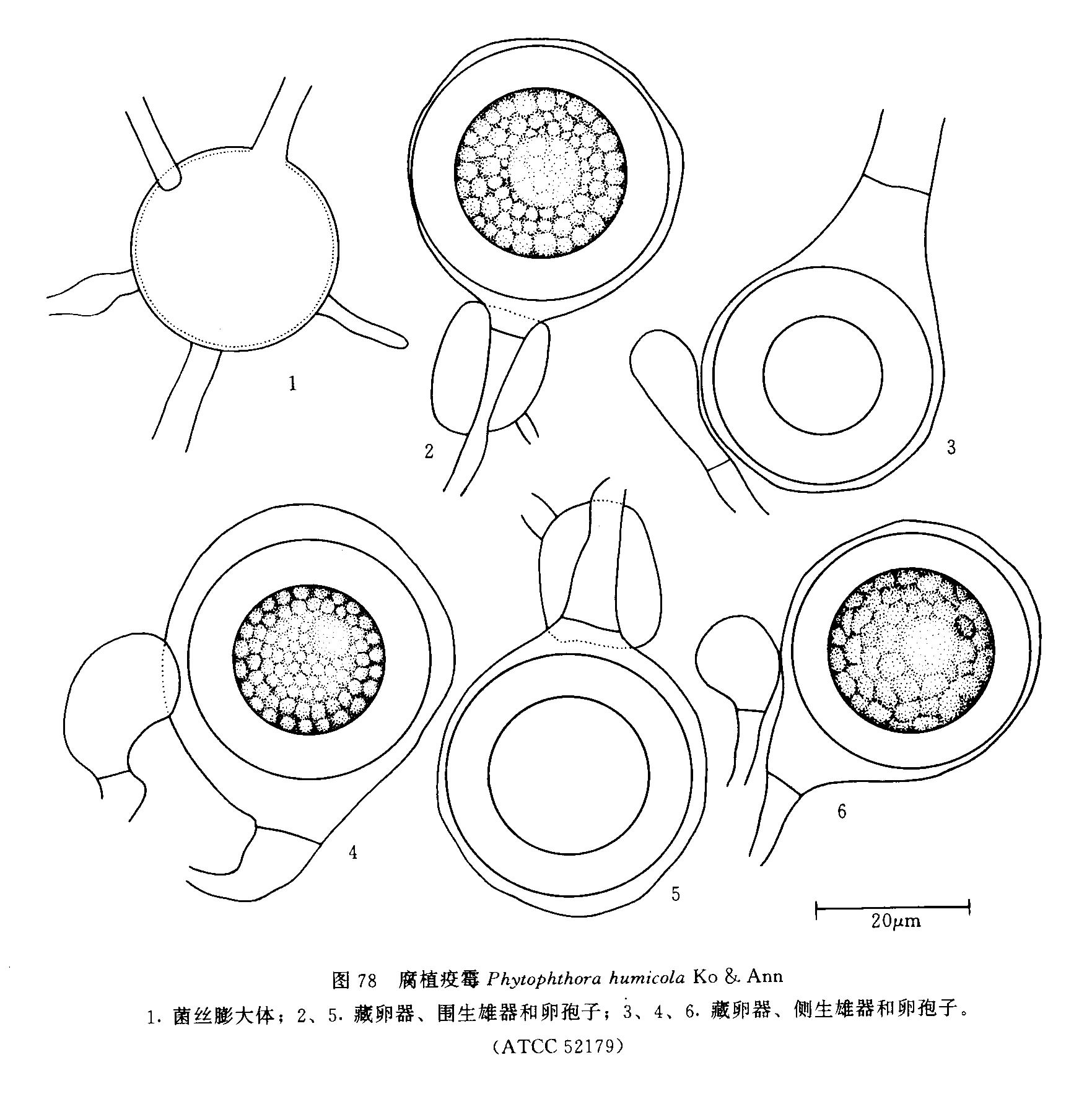 如孢子囊无乳突,不脱落,具层出现象,藏卵器和卵孢子均较大并具侧生雄