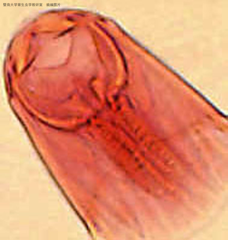  p>十二指肠钩口线虫(ancylostoma duodenale),简称为十二指肠钩虫,寄