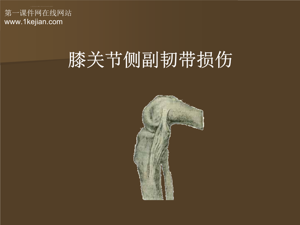 膝副韧带损伤