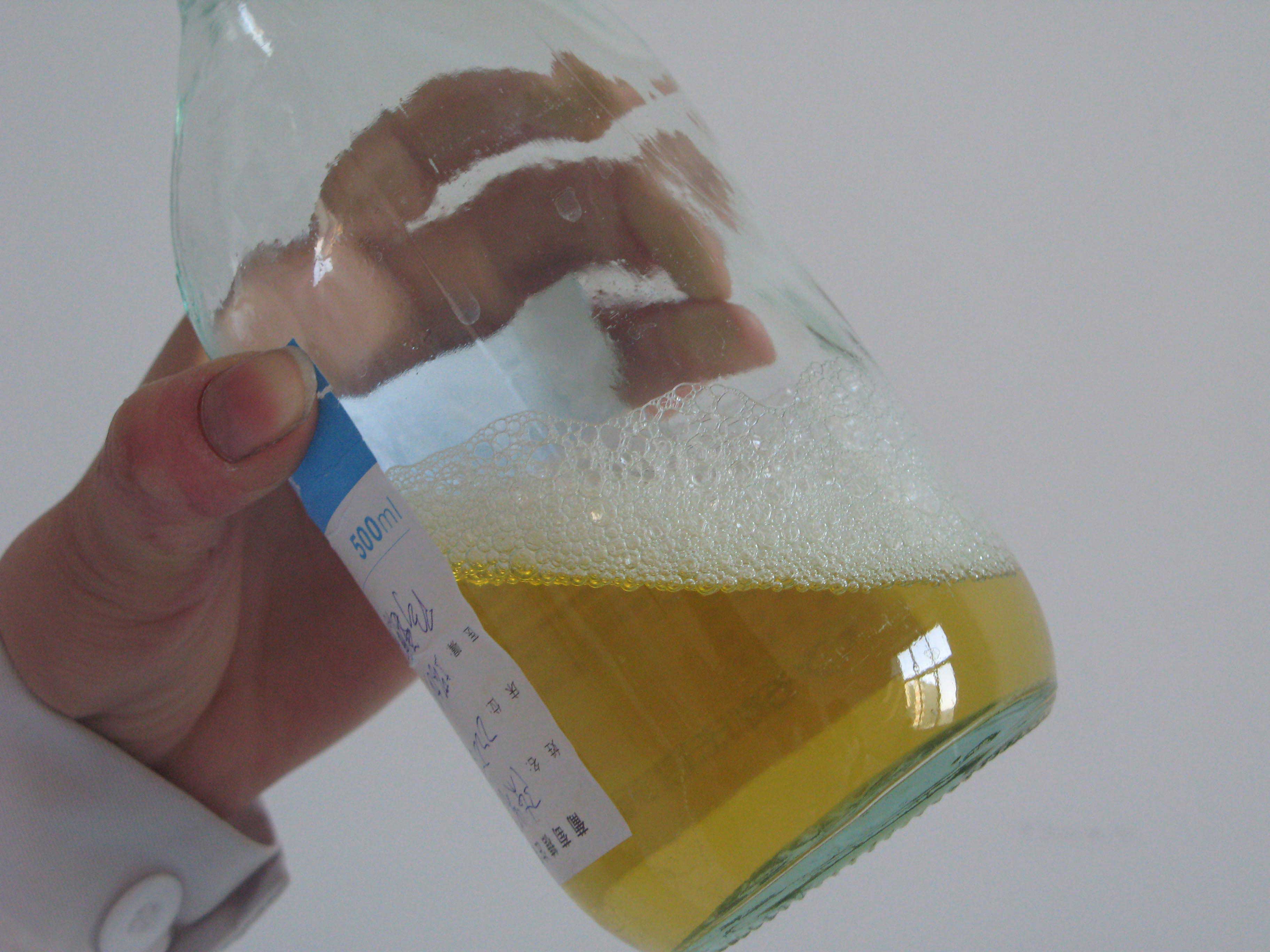 ">尿常规检查 /a>或是 a target="_blank" href="/item/24小时尿蛋白