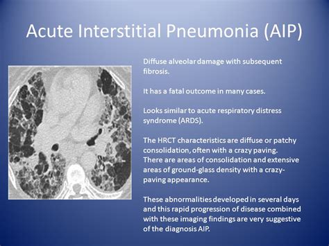 acuter pneumonia