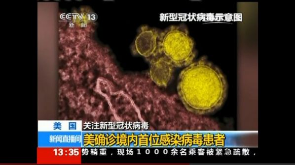 新型冠状病毒示意图