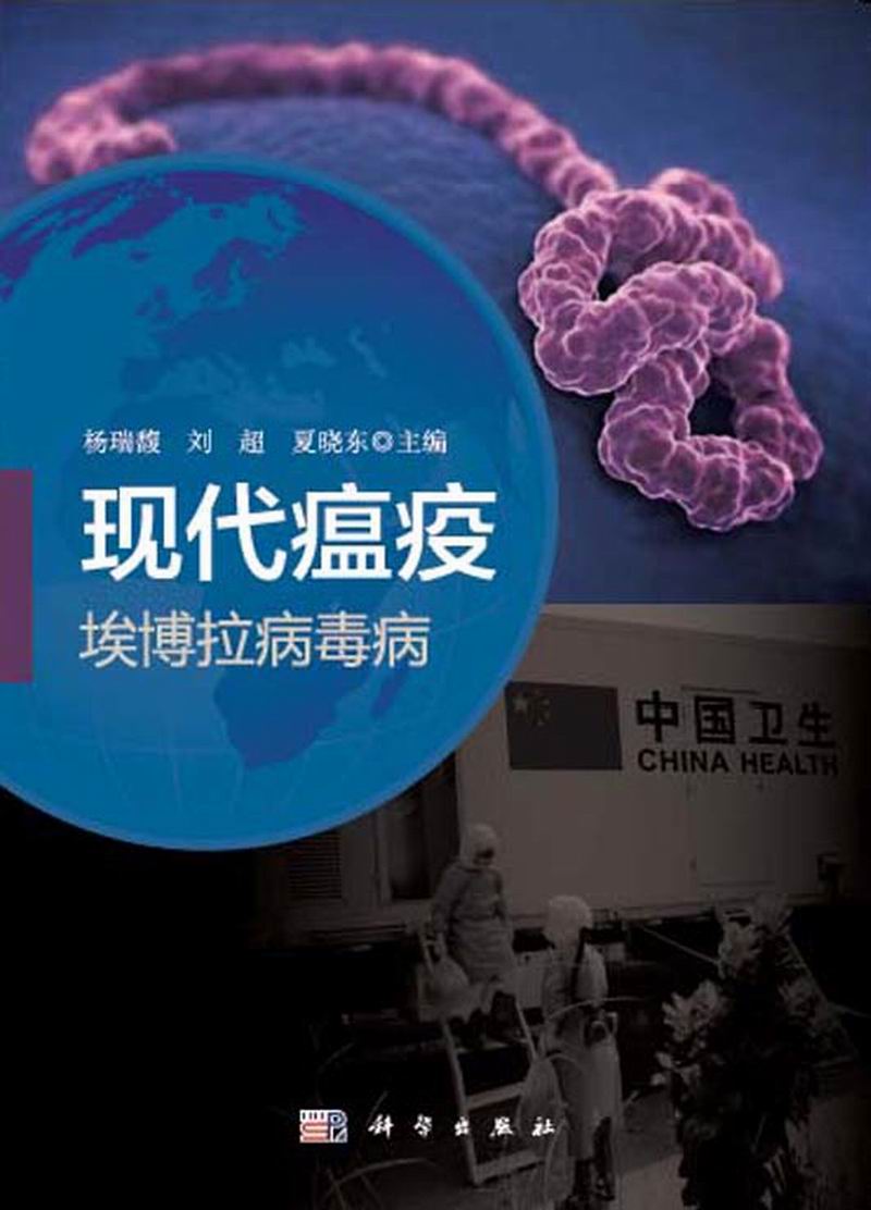现代瘟疫――埃博拉病毒病