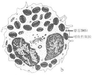 特发性嗜酸性粒细胞增多症