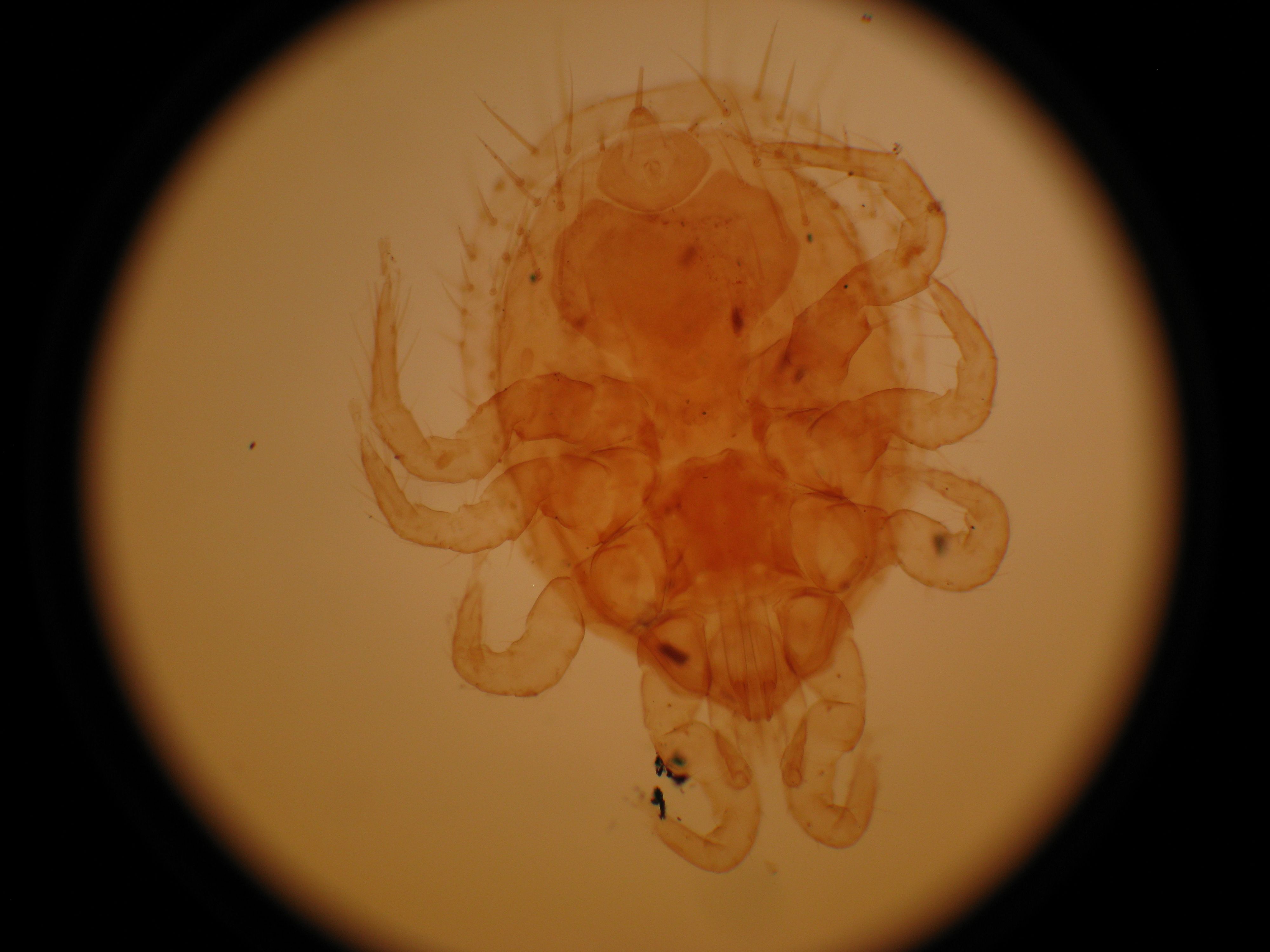 属蛛形纲,螨目, a target="_blank" href="/item/革螨/6266695" data