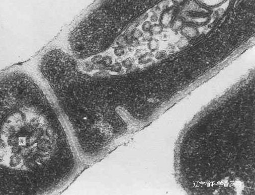 白喉 /a>的病原菌,属于 a href="#" data-lemmaid="8225101">棒状杆菌