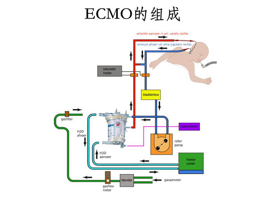  p>ecmo i>(extracorporeal membrane oxygenation) /i>,中文名体外膜