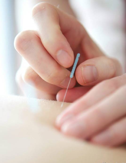 针灸（刺针来治疗疾病）_百度百科