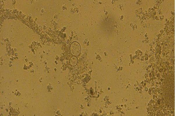 布氏艾美耳球虫