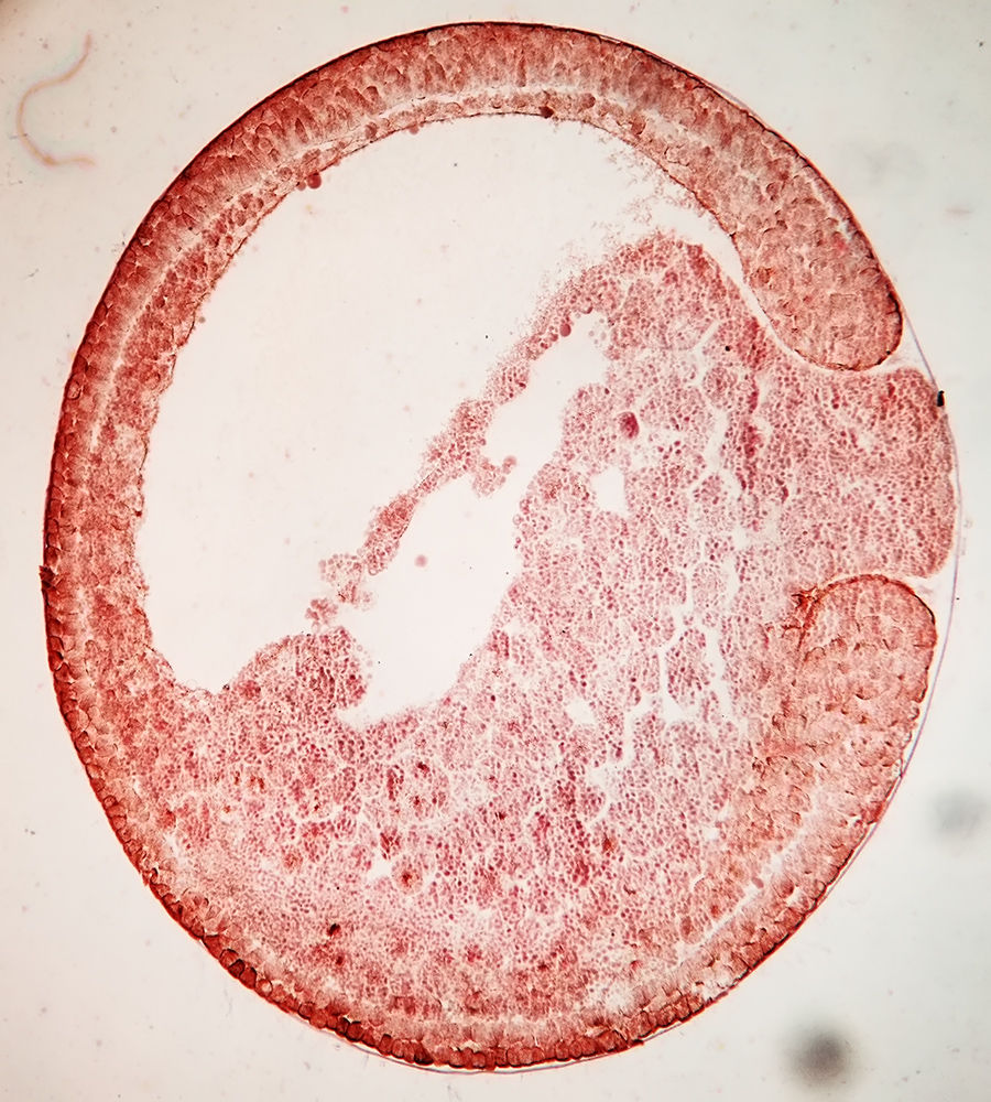 原肠胚(gastrula)是指具双 a href="#" data-lemmaid="568323">胚层 