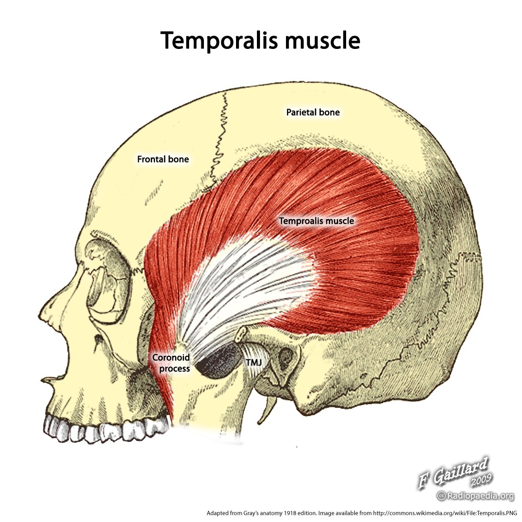  p>颞肌(temporalis),起自 a href="#" data-lemmaid="591333">颞窝 