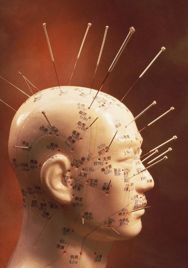 针灸穴位治疗常见病一本通:溃疡性结肠炎