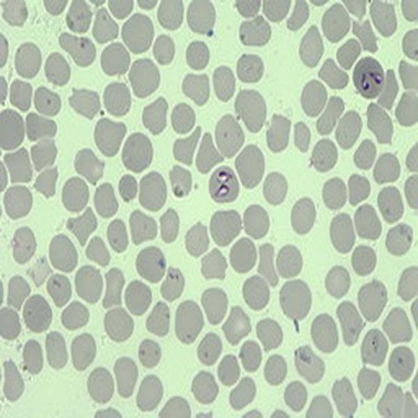 卵形巴贝斯虫(张家川株)