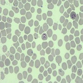 卵形巴贝斯虫(张家川株)