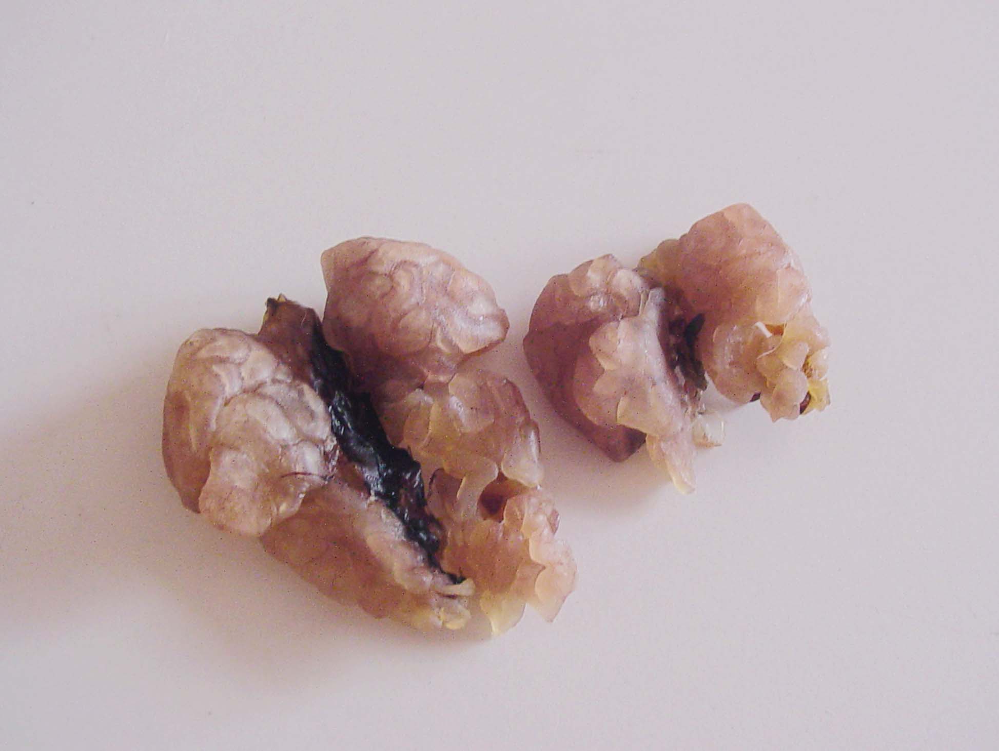  p>这个相当长而窄小的沟形蛤壳在前部最宽,口也位于前部,往后则慢慢