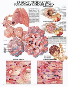 慢性阻塞性肺炎(obstructive pulmonary emphysema)又称阻塞性肺气肿