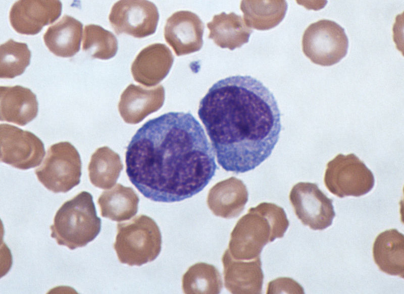  p>单核细胞(monocytes)是血液中最大的 a href="#" data-lemmaid="