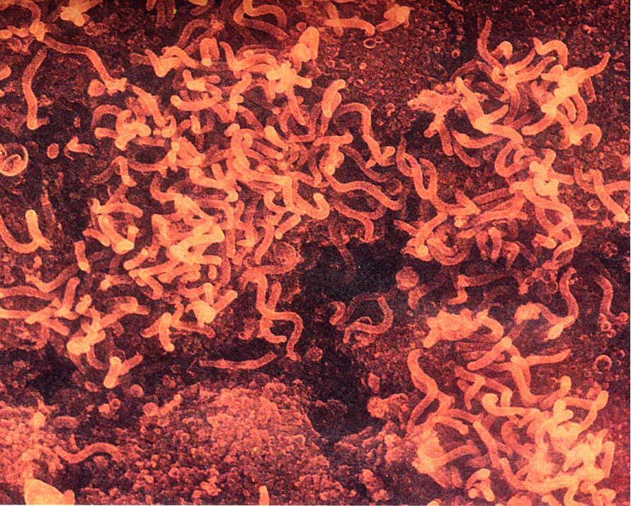 spp)泛指 a href="#" data-lemmaid="2261719">利什曼虫属 /a>的 a