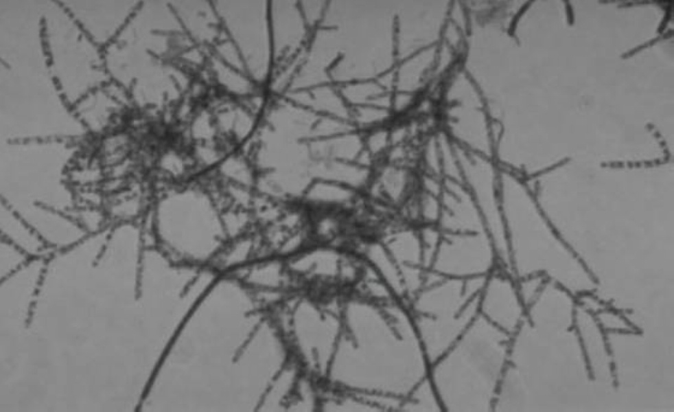 href="#" data-lemmaid="1189783">菌丝 /a>的一类 a href="#" data