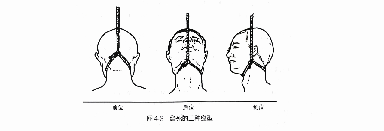 缢死_百度百科