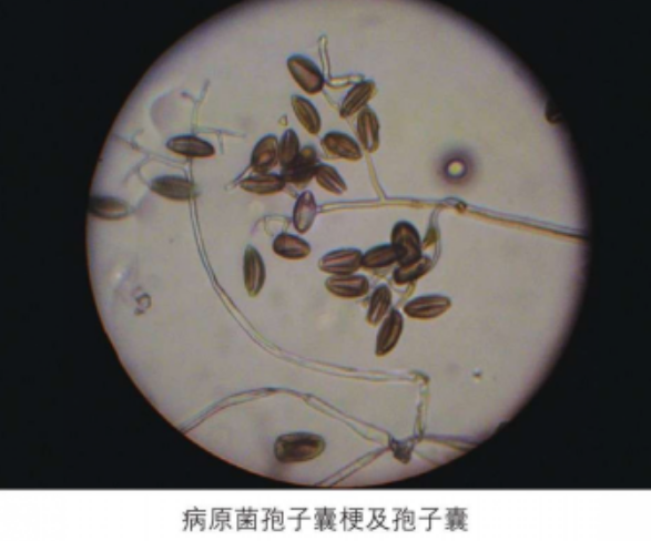  p>葫芦霜霉病是由 a target="_blank" href="/item/古巴假霜霉