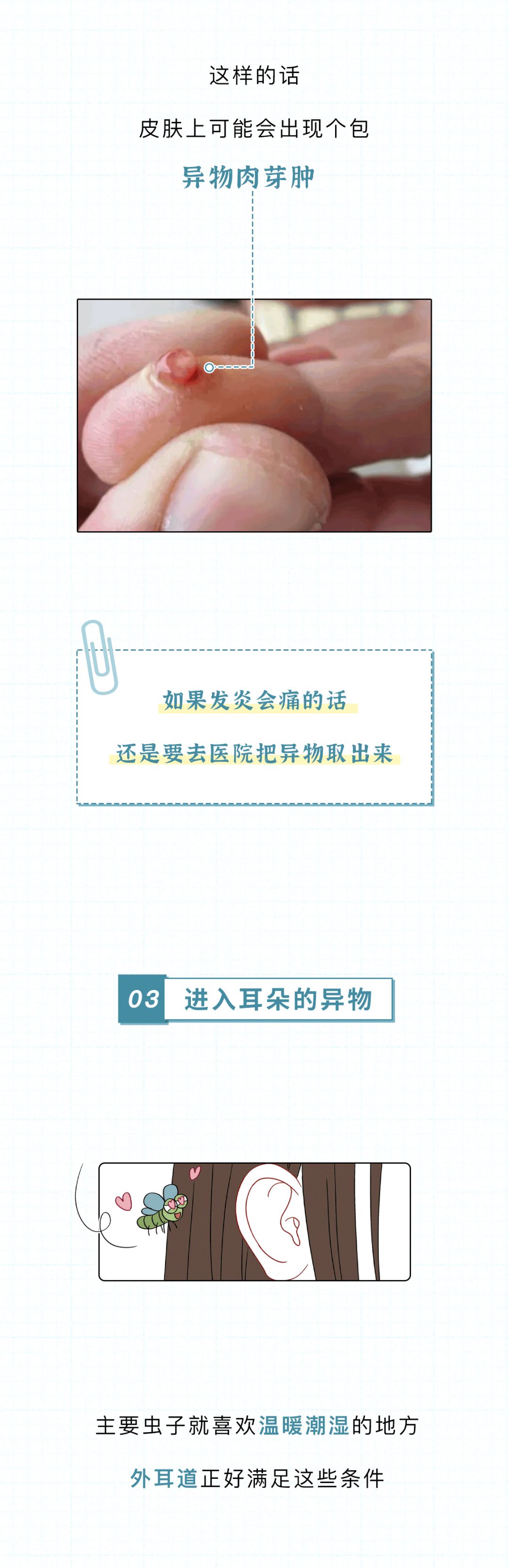 那些进入身体的异物，最后都去哪儿了？_百科TA说