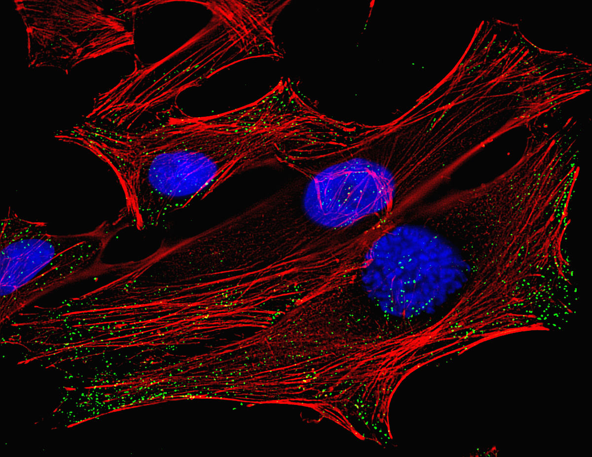 data-lemmaid="1591125">成纤维细胞 /a>微丝的染色及其对细胞松弛素b