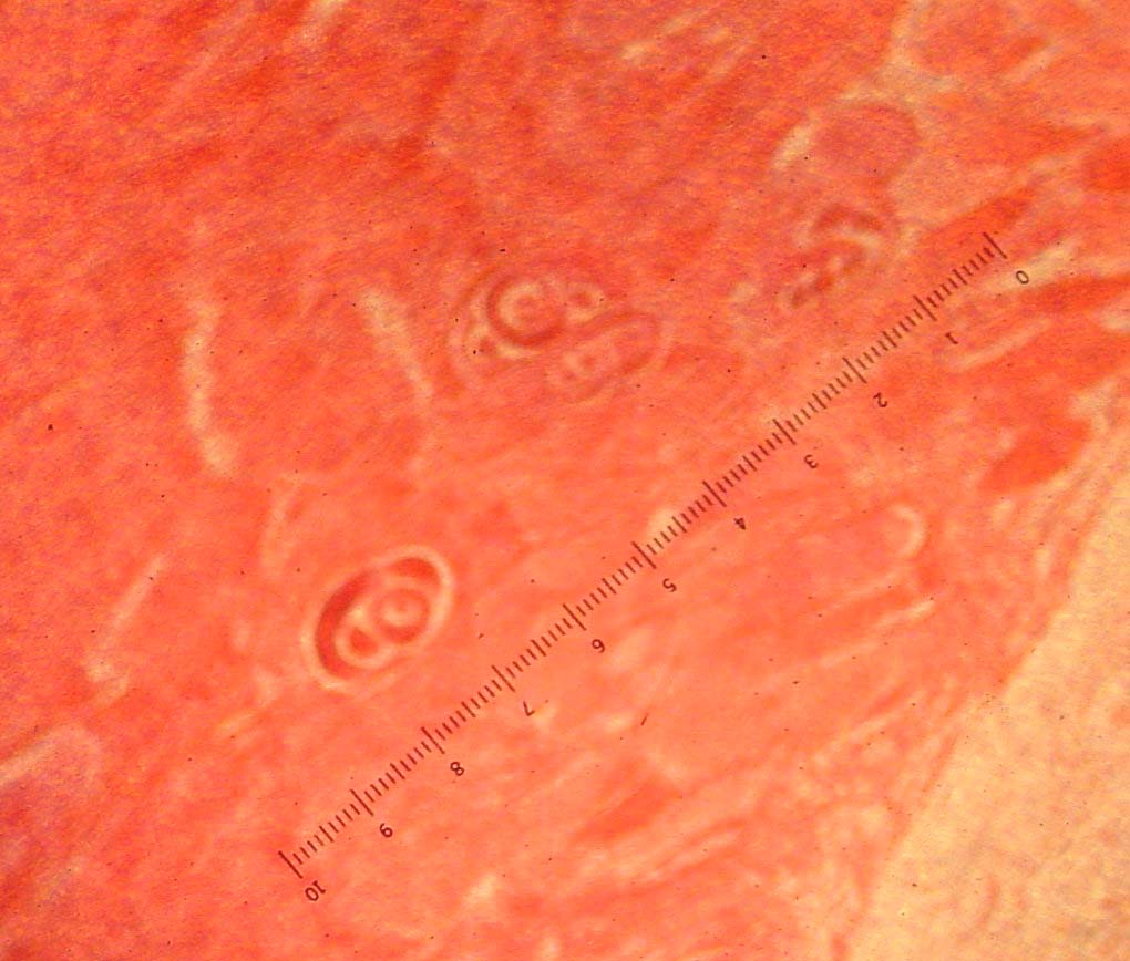  p>旋毛虫 a href="#" data-lemmaid="2697752">幼虫寄生 /a>于肌纤维