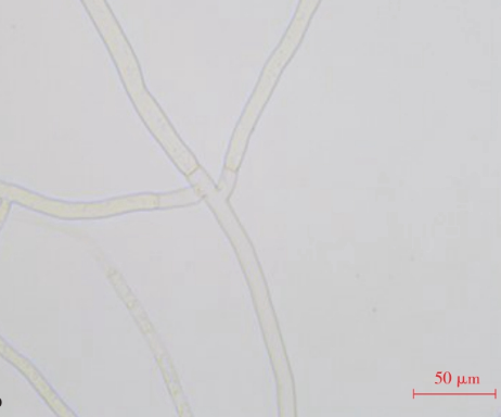  p>甘蓝黑根病是由立枯丝核菌引起的,发生在 a target="_blank" href=