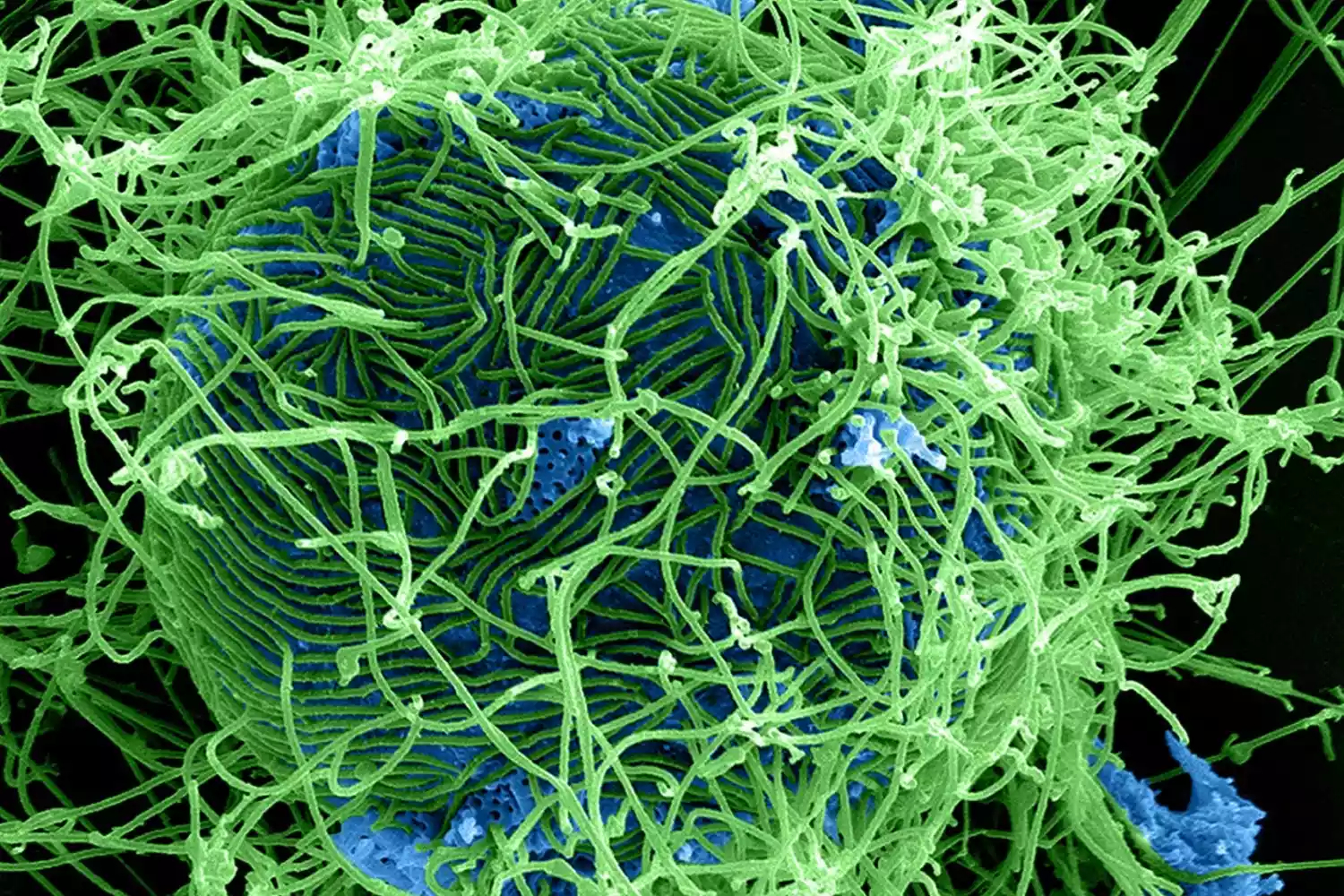  p>埃博拉病毒(ebola virus)又译作伊波拉病毒.