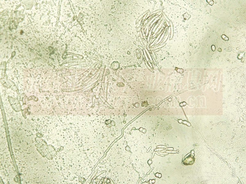  p>青霉属指的是 a target="_blank" href="/item/子囊菌门/8651739"