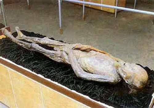 href="/item/尸体现象">尸体现象 /a>之一,指尸体腐烂变化的过程,原因