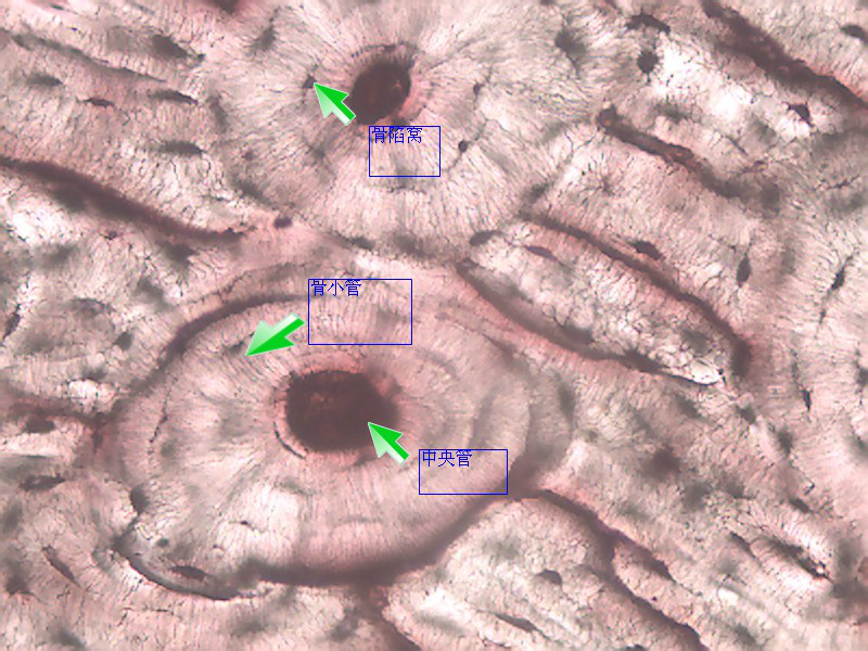  p>哈佛系统,亦作哈弗管或哈弗斯管,在 a target="_blank" href="