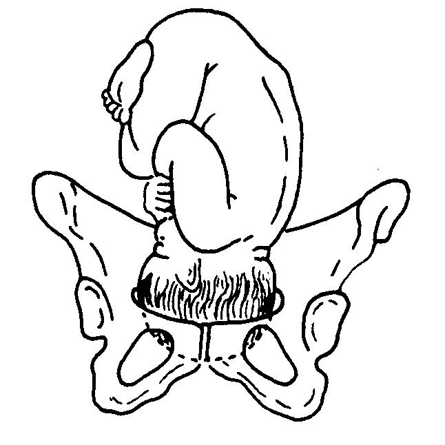  p>骨盆(pelvis)是 a href="#" data-lemmaid="7250752">躯干 /a>和