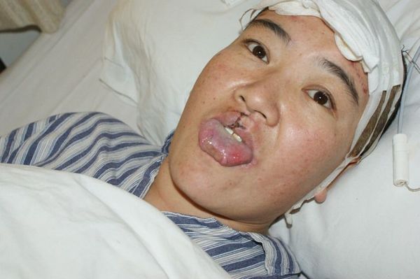  p>梅杰综合症是由法国 a href="#" data-lemmaid="11031424">神经病