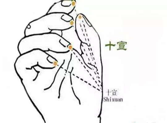 十宣穴