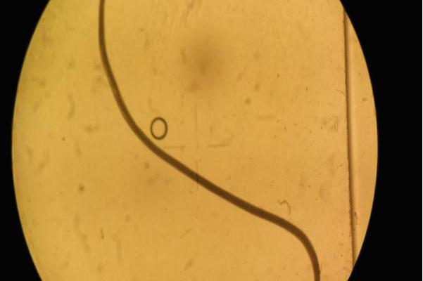 辐射食道口线虫