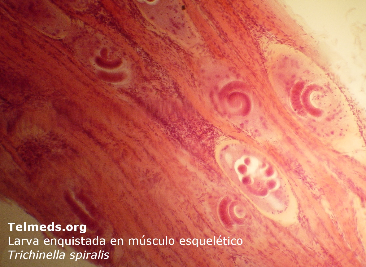  p>旋毛虫 a target="_blank" href="/item/幼虫寄生/2697752" data