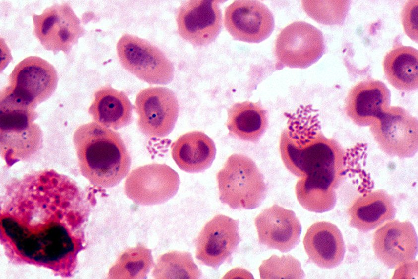  p> a href="#" data-lemmaid="10072121">布鲁氏杆菌 /a>(brucella)