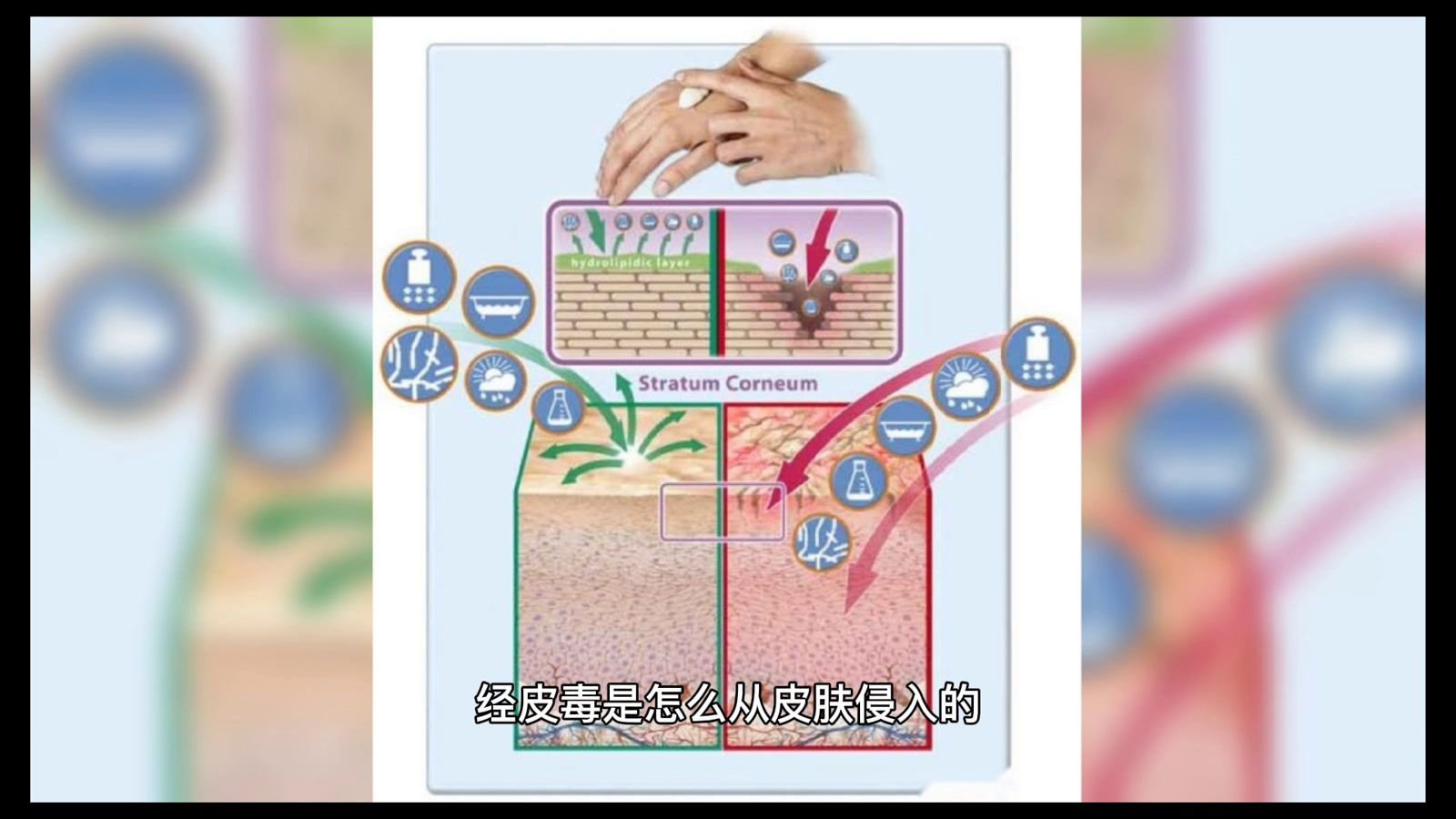 远离经皮毒_百度百科