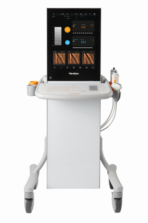 FibroScan_百度百科