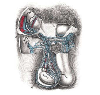 精索静脉曲张不育