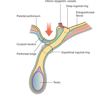  p>即"腹股沟内环".