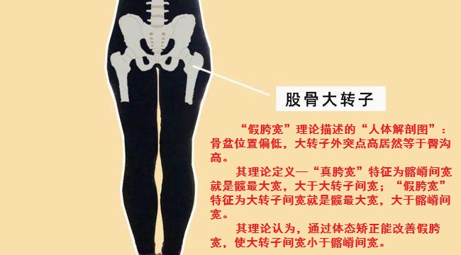 测量 /a>中髂宽即 a target="_blank" href="/item/骨盆宽/53874759"