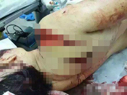 7·15龙门县医院砍人事件