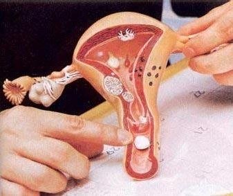 阴道流出黄色或血性带臭味的分泌物