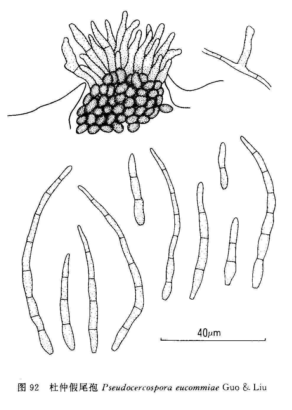  p>杜仲假尾孢,黑霉科真菌的一种,直径 22.0-50.0μm. /p>