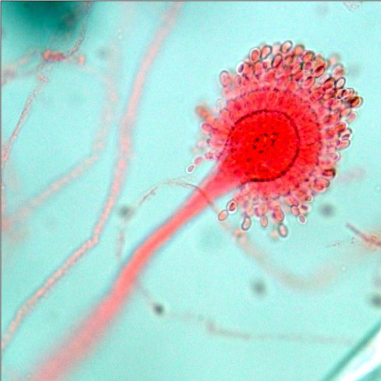  p>子囊菌亚门(ascomycotina) 真菌门中最大的一亚门.