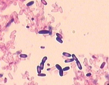  p>产气荚膜杆菌( i>clostridium perfringen /i>),又名魏氏梭菌( i>